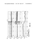 DETECTING HEMODYNAMIC STABILITY DURING  ARRHYTHMIA USING THE CHANGES IN     ATRIAL ACTIVATION diagram and image