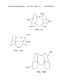 Contoured Support Brace diagram and image