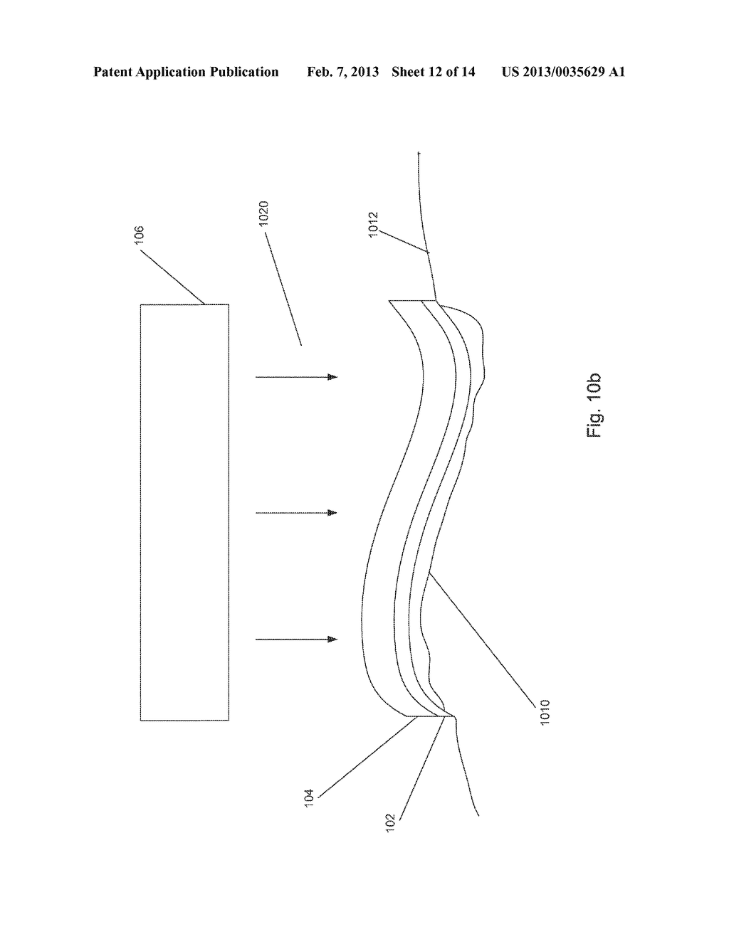 OPTICAL BANDAGE TO STERILIZE WOUNDS - diagram, schematic, and image 13