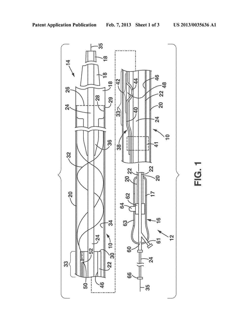 Delivery and Deployment Catheter for an Implantable Medical Device - diagram, schematic, and image 02