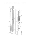 ANGIOPLASTY ASSEMBLY diagram and image