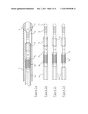 ANGIOPLASTY ASSEMBLY diagram and image