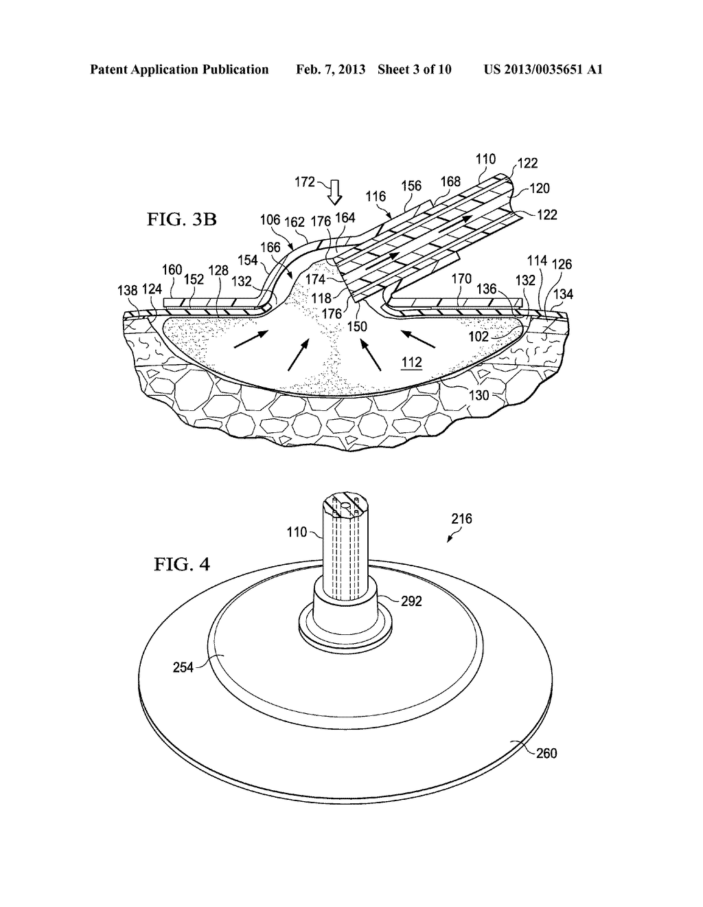 SYSTEMS AND METHODS FOR TREATING A TISSUE SITE WITH REDUCED PRESSURE     INVOLVING A REDUCED-PRESSURE INTERFACE HAVING A MULTI-LUMEN CONDUIT FOR     CONTACTING A MANIFOLD - diagram, schematic, and image 04