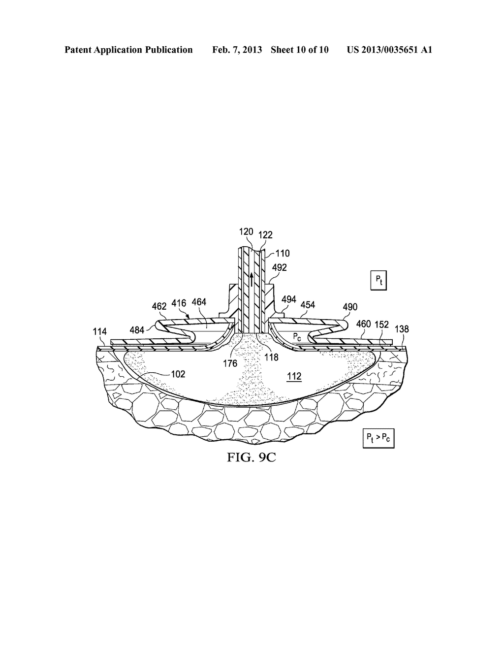 SYSTEMS AND METHODS FOR TREATING A TISSUE SITE WITH REDUCED PRESSURE     INVOLVING A REDUCED-PRESSURE INTERFACE HAVING A MULTI-LUMEN CONDUIT FOR     CONTACTING A MANIFOLD - diagram, schematic, and image 11