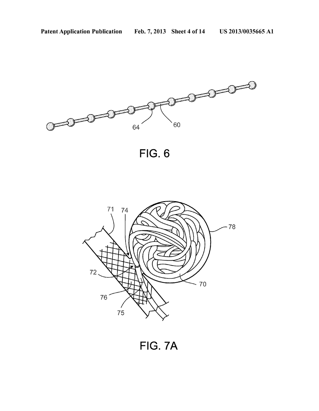 Polymer-Based Occlusion Devices, Systems and Methods - diagram, schematic, and image 05