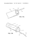 Polymer-Based Occlusion Devices, Systems and Methods diagram and image