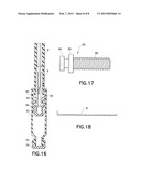 Stopper/Plunger for Carpules of Syringe-Carpule assembly diagram and image