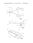 TISSUE FUSION INSTRUMENT, IN PARTICULAR A TISSUE FUSION FORCEPS diagram and image