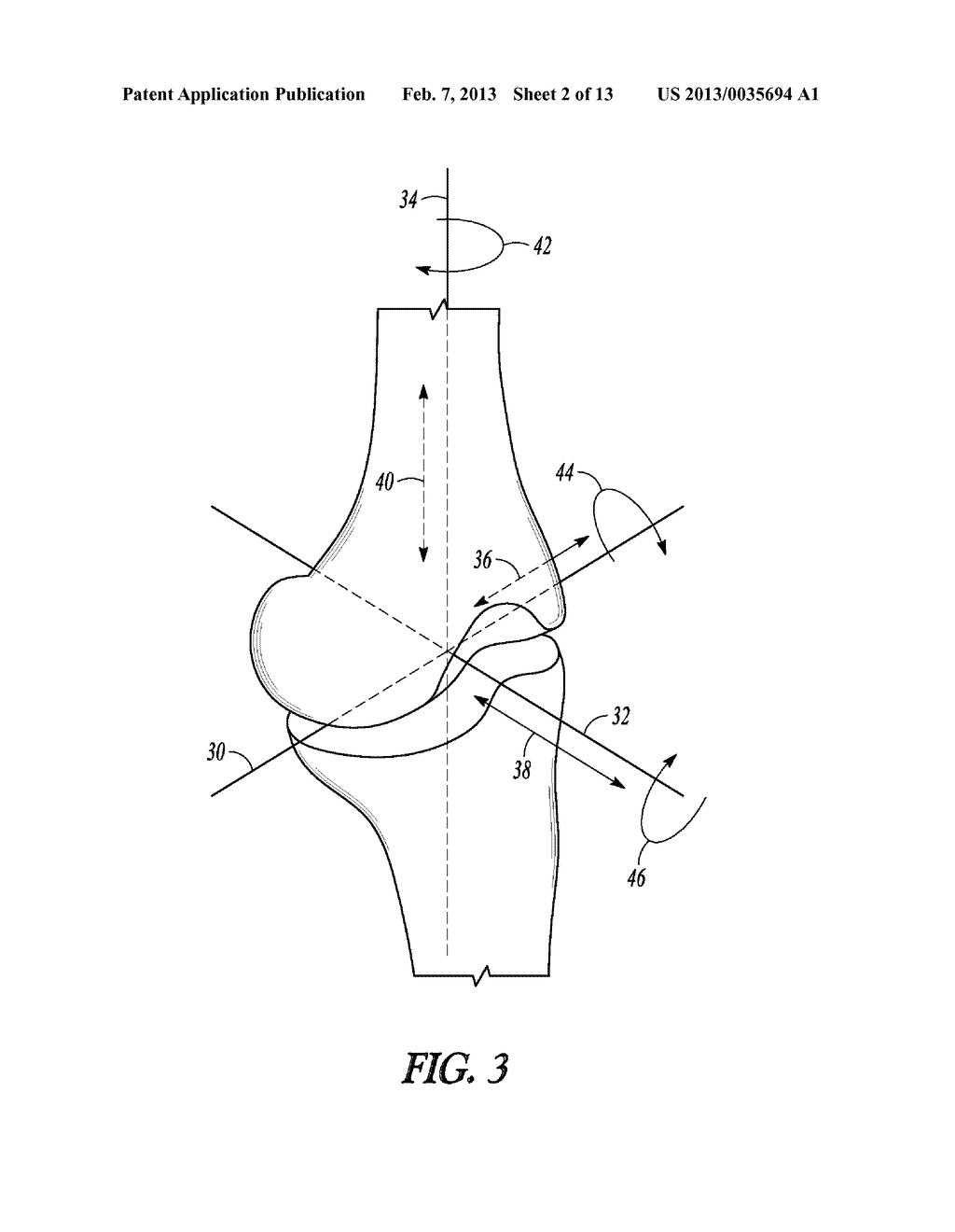 COMBINATION LIGAMENT TENSIONER AND ALIGNMENT DEVICE - diagram, schematic, and image 03