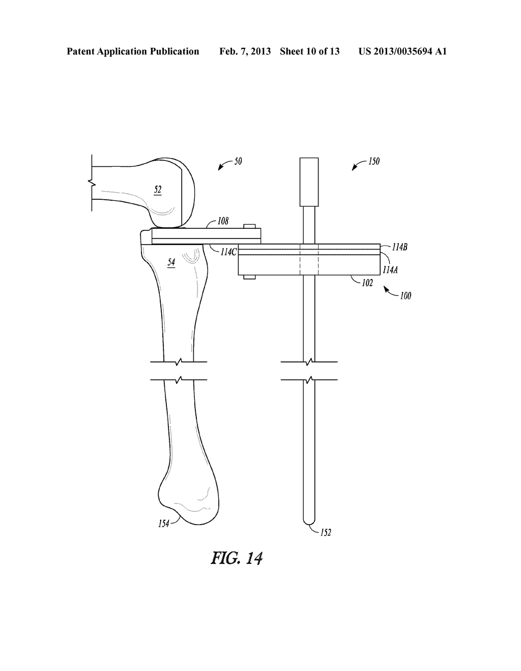 COMBINATION LIGAMENT TENSIONER AND ALIGNMENT DEVICE - diagram, schematic, and image 11