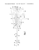 Soft Tissue Repair Device And Associated Method diagram and image