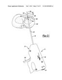 Soft Tissue Repair Device And Associated Method diagram and image