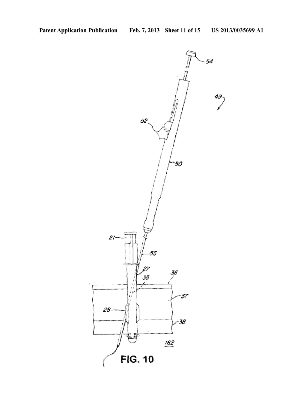 DUAL INSUFFLATION AND WOUND CLOSURE DEVICES AND METHODS - diagram, schematic, and image 12