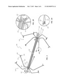 Vascular Filter diagram and image