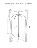 Vascular Filter diagram and image