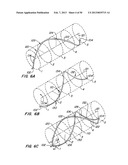 DEVICES AND METHODS FOR VESSEL OCCLUSION diagram and image