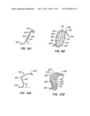 DEVICES AND METHODS FOR VESSEL OCCLUSION diagram and image