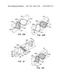 DEVICES AND METHODS FOR VESSEL OCCLUSION diagram and image