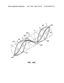 DEVICES AND METHODS FOR VESSEL OCCLUSION diagram and image