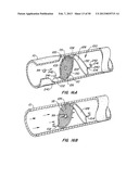 DEVICES AND METHODS FOR VESSEL OCCLUSION diagram and image