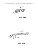 DEVICES AND METHODS FOR VESSEL OCCLUSION diagram and image