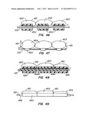 DEVICES AND METHODS FOR VESSEL OCCLUSION diagram and image