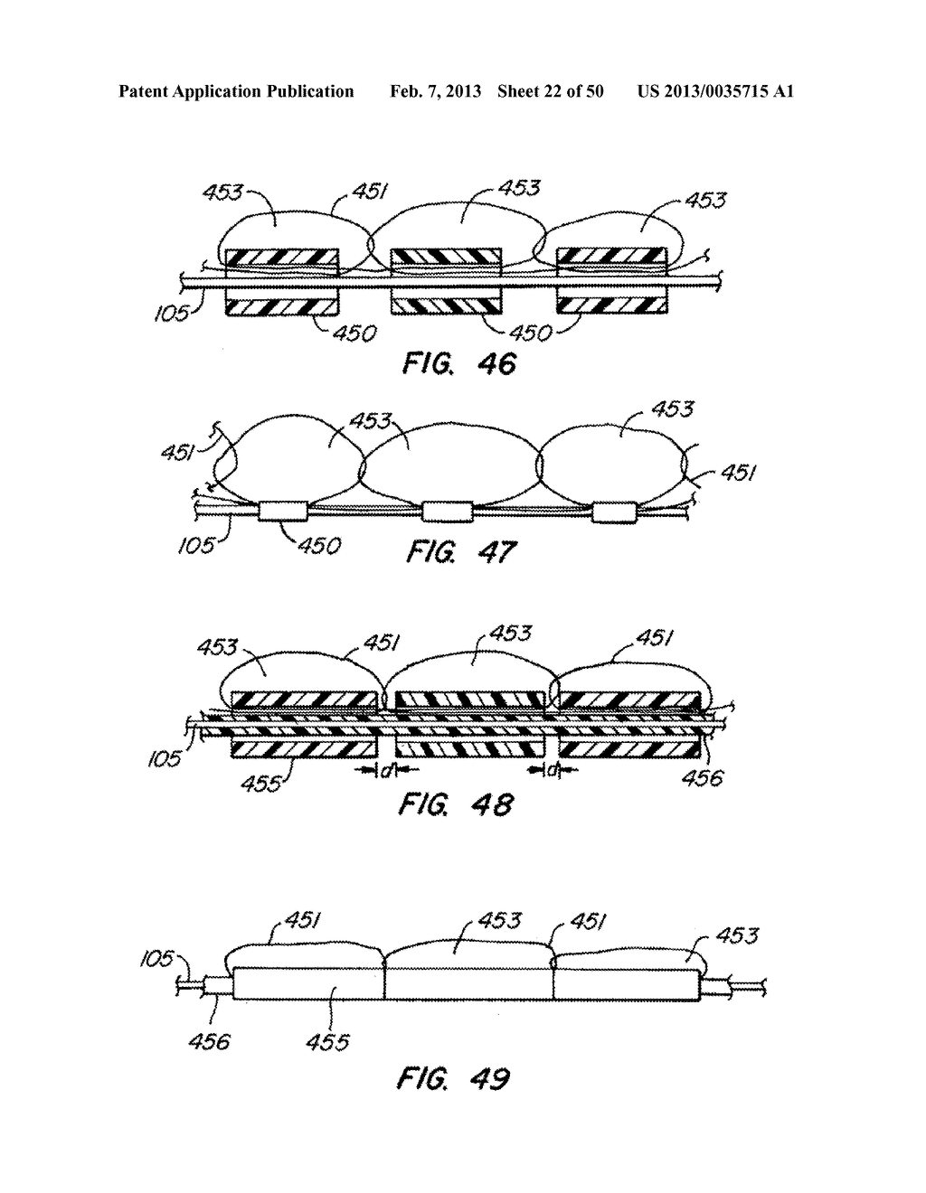 DEVICES AND METHODS FOR VESSEL OCCLUSION - diagram, schematic, and image 23