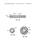 DEVICES AND METHODS FOR VESSEL OCCLUSION diagram and image