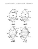 DEVICES AND METHODS FOR VESSEL OCCLUSION diagram and image