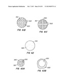 DEVICES AND METHODS FOR VESSEL OCCLUSION diagram and image