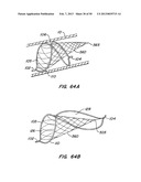 DEVICES AND METHODS FOR VESSEL OCCLUSION diagram and image