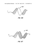 DEVICES AND METHODS FOR VESSEL OCCLUSION diagram and image