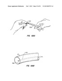 DEVICES AND METHODS FOR VESSEL OCCLUSION diagram and image