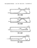 DEVICES AND METHODS FOR VESSEL OCCLUSION diagram and image