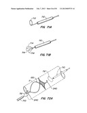 DEVICES AND METHODS FOR VESSEL OCCLUSION diagram and image