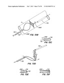 DEVICES AND METHODS FOR VESSEL OCCLUSION diagram and image