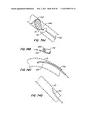 DEVICES AND METHODS FOR VESSEL OCCLUSION diagram and image