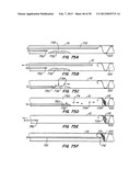 DEVICES AND METHODS FOR VESSEL OCCLUSION diagram and image