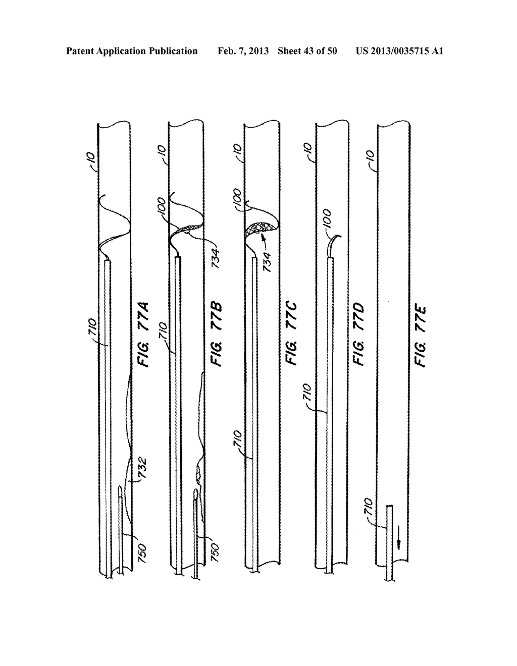 DEVICES AND METHODS FOR VESSEL OCCLUSION - diagram, schematic, and image 44