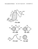 DEVICES AND METHODS FOR VESSEL OCCLUSION diagram and image