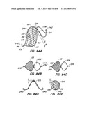 DEVICES AND METHODS FOR VESSEL OCCLUSION diagram and image