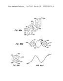 DEVICES AND METHODS FOR VESSEL OCCLUSION diagram and image