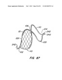 DEVICES AND METHODS FOR VESSEL OCCLUSION diagram and image