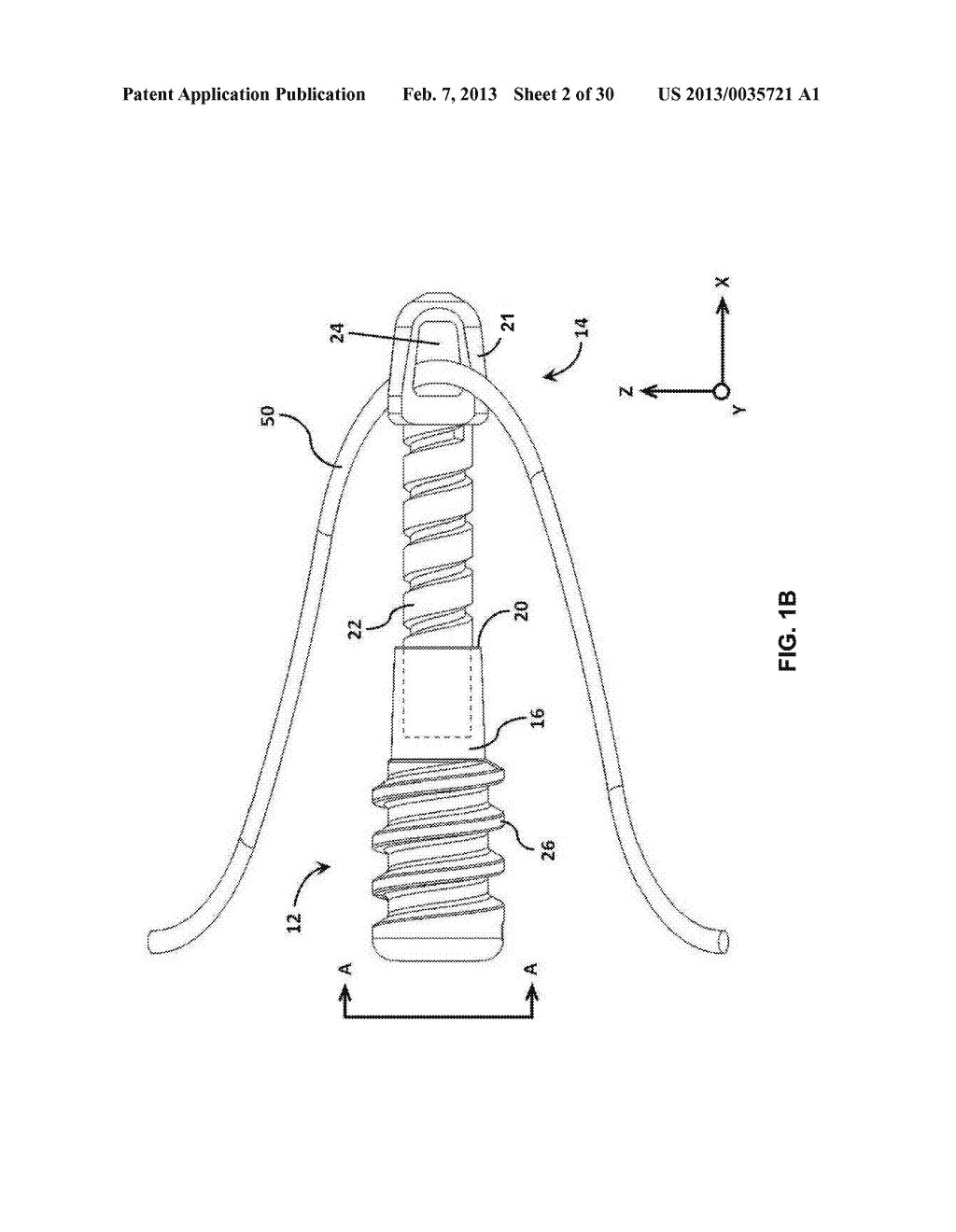 SURGICAL ANCHOR - diagram, schematic, and image 03