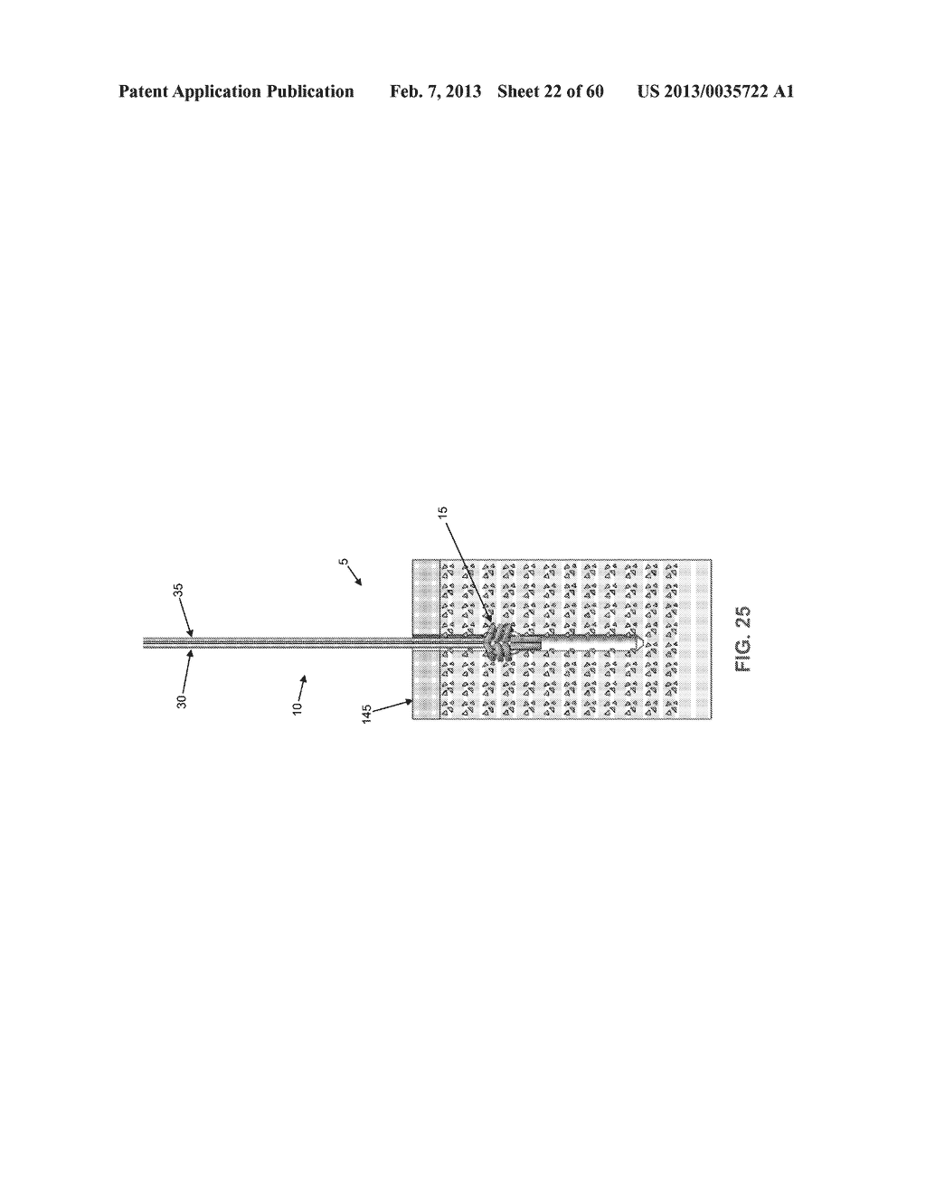 METHOD AND APPARATUS FOR SECURING AN OBJECT TO BONE, INCLUDING THE     PROVISION AND USE OF A NOVEL SUTURE ASSEMBLY FOR SECURING AN OBJECT TO     BONE - diagram, schematic, and image 23