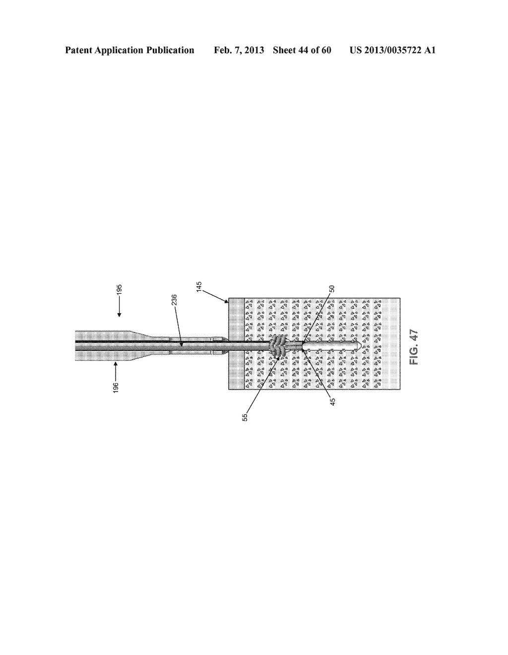 METHOD AND APPARATUS FOR SECURING AN OBJECT TO BONE, INCLUDING THE     PROVISION AND USE OF A NOVEL SUTURE ASSEMBLY FOR SECURING AN OBJECT TO     BONE - diagram, schematic, and image 45