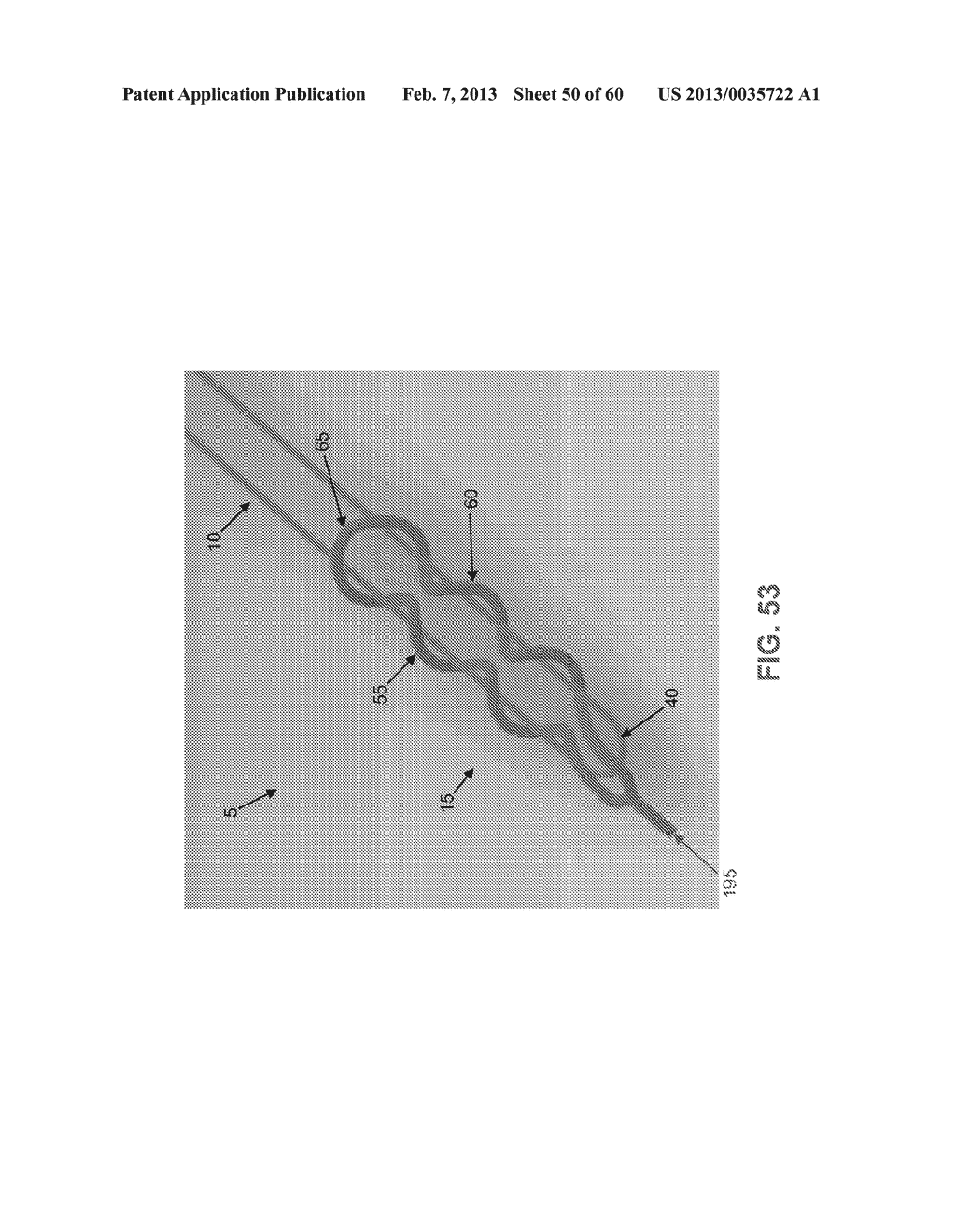 METHOD AND APPARATUS FOR SECURING AN OBJECT TO BONE, INCLUDING THE     PROVISION AND USE OF A NOVEL SUTURE ASSEMBLY FOR SECURING AN OBJECT TO     BONE - diagram, schematic, and image 51