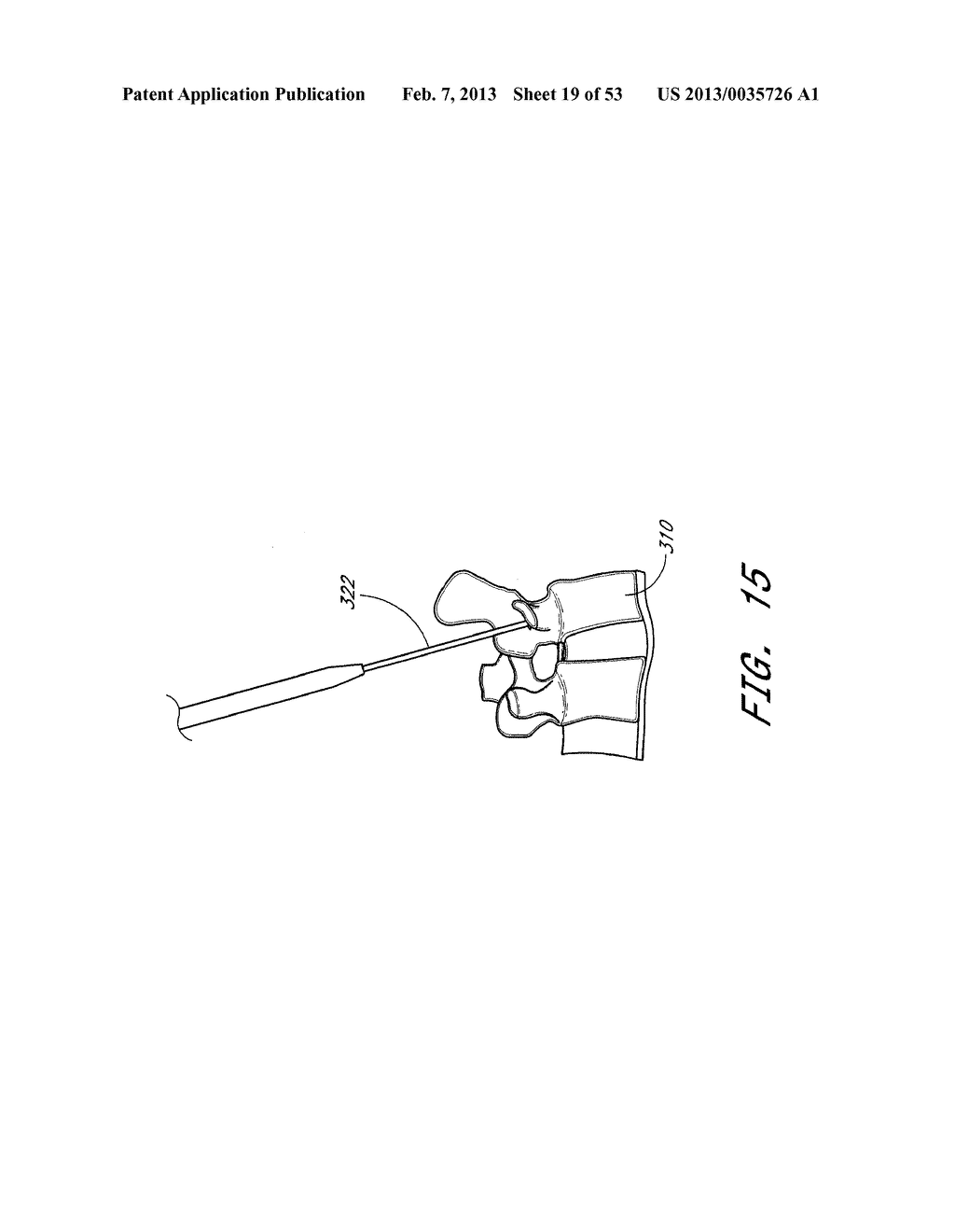 SYSTEM AND METHOD FOR MINIMALLY INVASIVE POSTERIOR FIXATION - diagram, schematic, and image 20