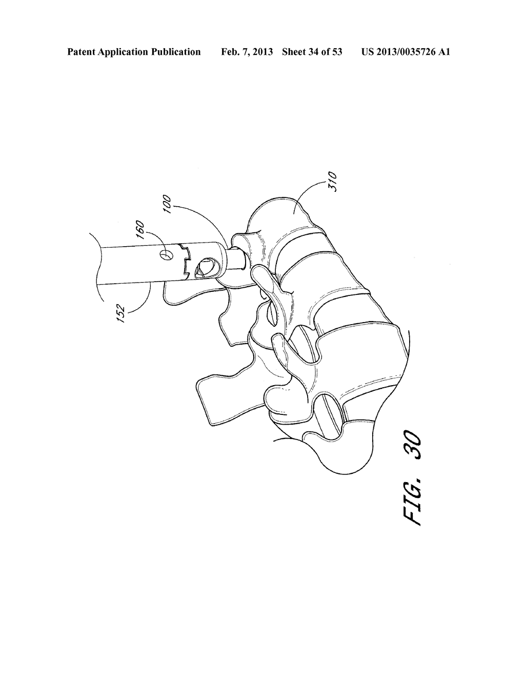 SYSTEM AND METHOD FOR MINIMALLY INVASIVE POSTERIOR FIXATION - diagram, schematic, and image 35