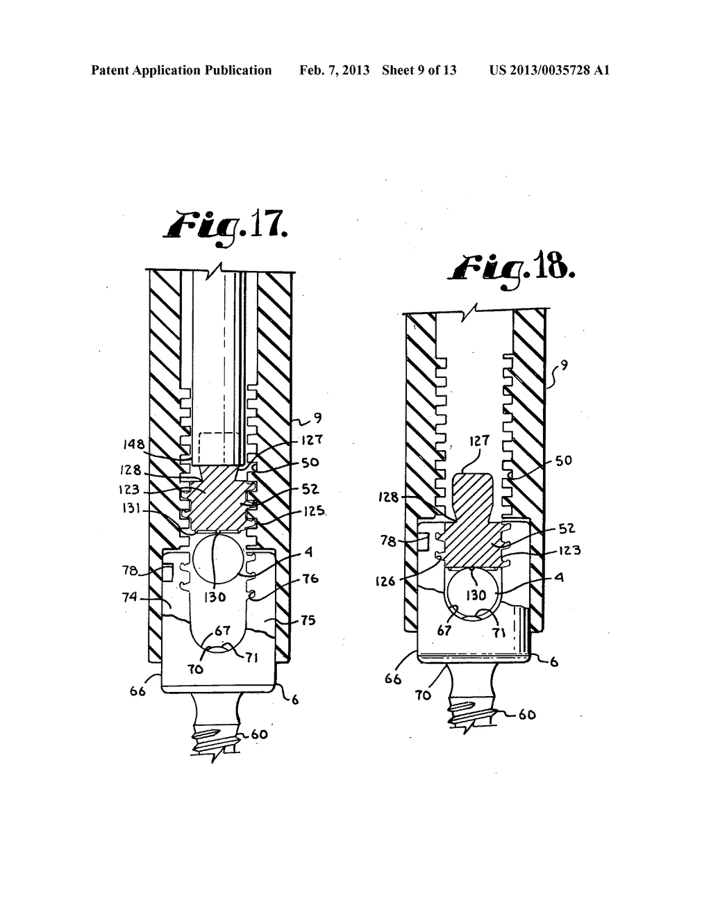 Orthopedic implant rod reduction tool set and method - diagram, schematic, and image 10